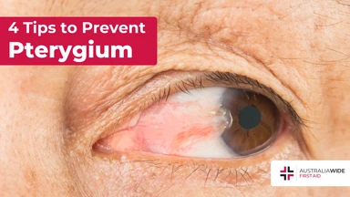 Prevent pterygium article header – First Aid Article in Nerang